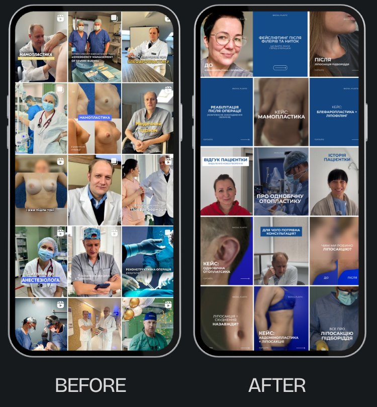 Before and after Instagram feed