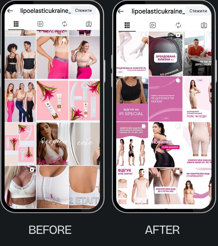 Lipoelastic before and after feed