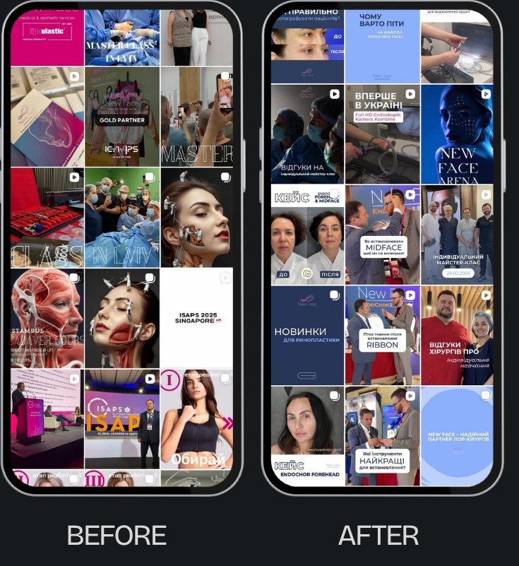 New Face before and after feed